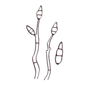 粟瘟病病原菌分生孢子梗和分生孢子
