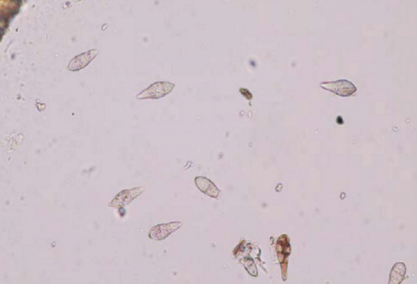 粟瘟病病原菌(梨形分生孢子)