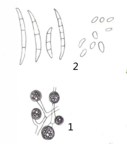 1厚垣孢子2大小型分生孢子