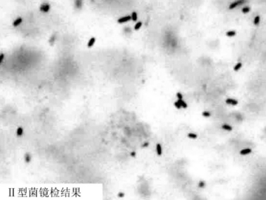 青枯假单胞杆菌小种1