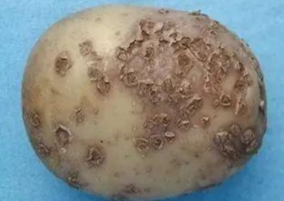 马铃薯粉痂病