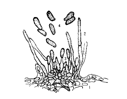 1-分生孢子盘；2-刚毛；3-分生孢子梗；4-分生孢子