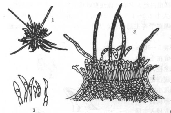 黄麻炭疽菌:图片说明:1.分生孢子;2.刚毛;3.分生孢子梗及分生孢子。