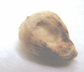 玉米干腐病籽粒变色