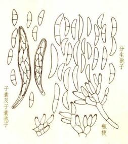 病原菌