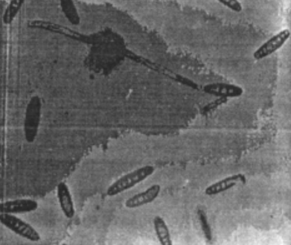 麦根腐平脐蠕孢分生孢子梗及分生孢子