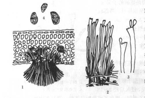 茶网饼病病原:1.病叶横切面;2.子实层部放大;3.担子和担孢子;4.担孢子放大