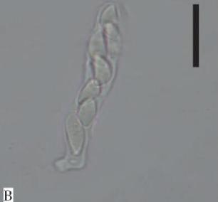 子囊及子囊孢子（10μm）