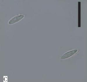 子囊孢子（10μm）