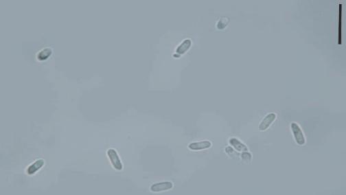 病原无性阶段的分生孢子（10μm）