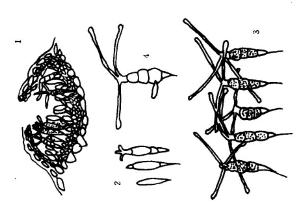 茶拟盘多毛孢：1.分生孢子盘；2.未成熟分生孢子；3.成熟的分生孢子；4.分生孢子萌发。