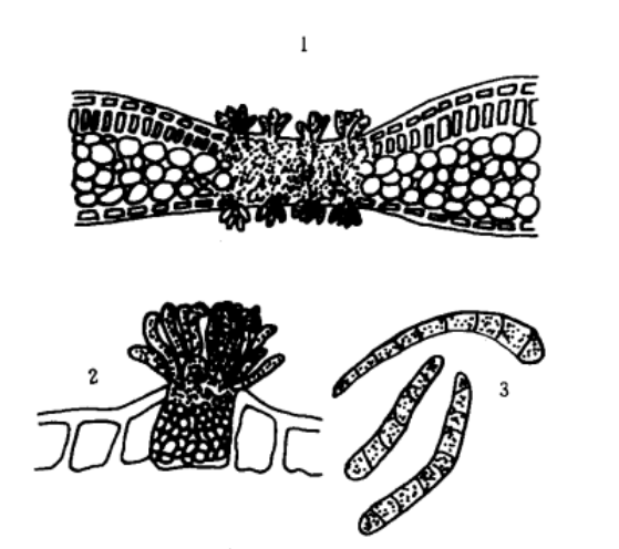 茶褐色叶斑病病原：1.病叶横断面；2.菌丝块和分生孢子梗；3.分生孢子。