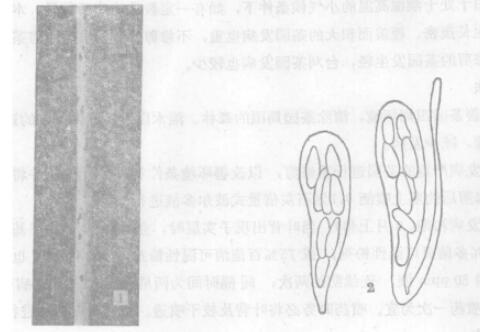 茶枝梢黑点病病原：1.病枝；2.病原菌的子囊、子囊孢子和侧丝。